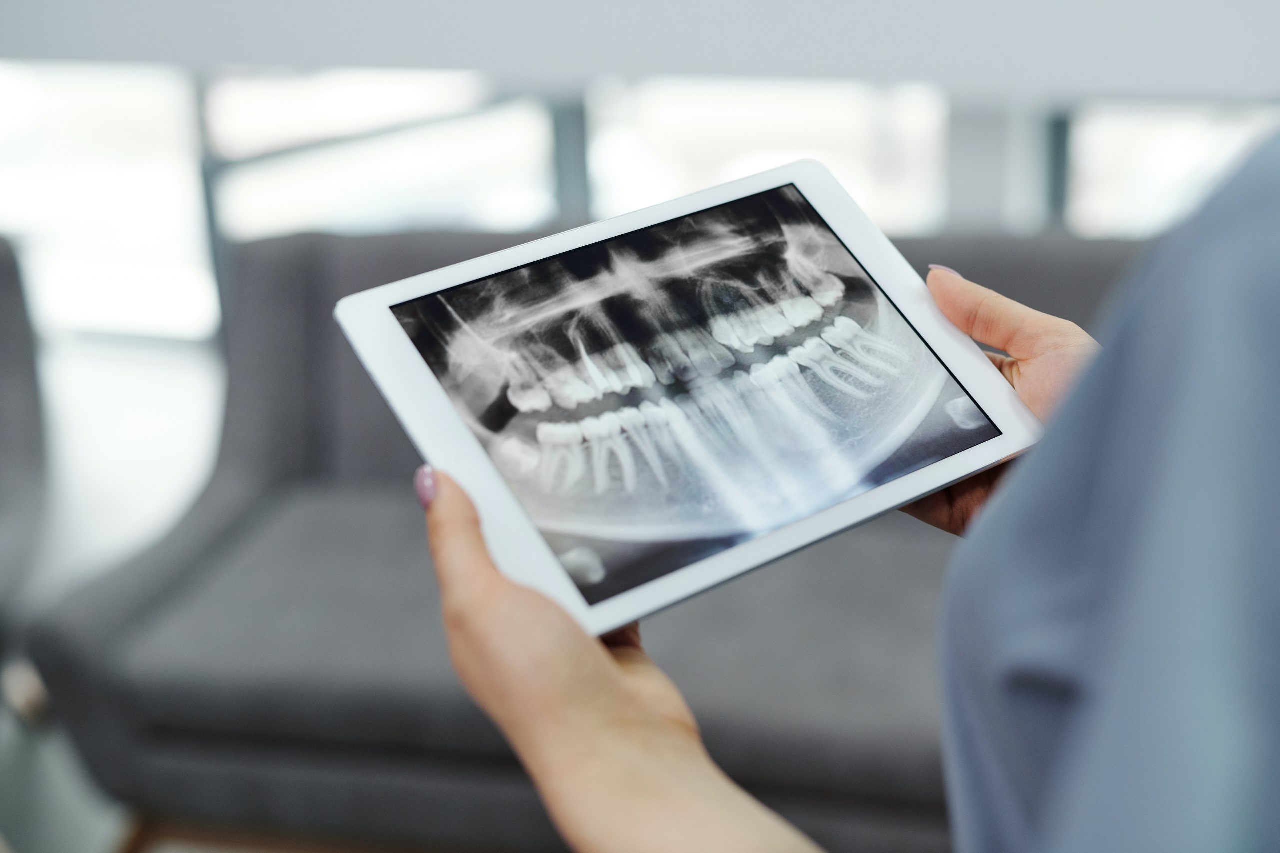 An image featuring a doctor holding a sample of a digital radiograph.